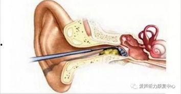 掏耳屎吃瓜,揭秘日常生活中的趣味小习惯